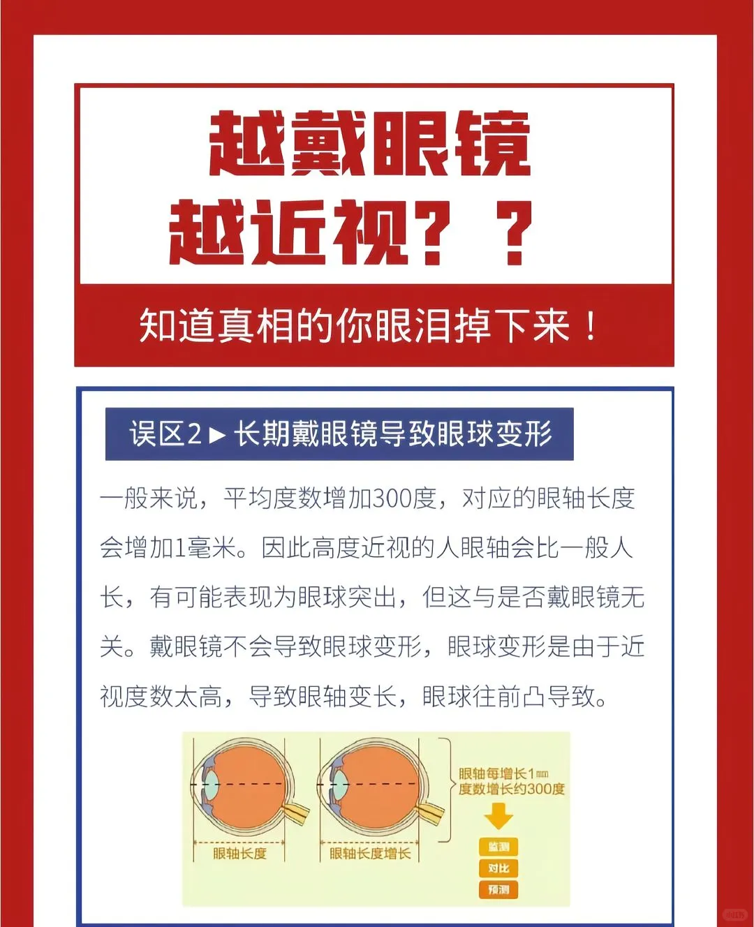 戴眼镜真的会让近视加深吗？?真相大揭秘！