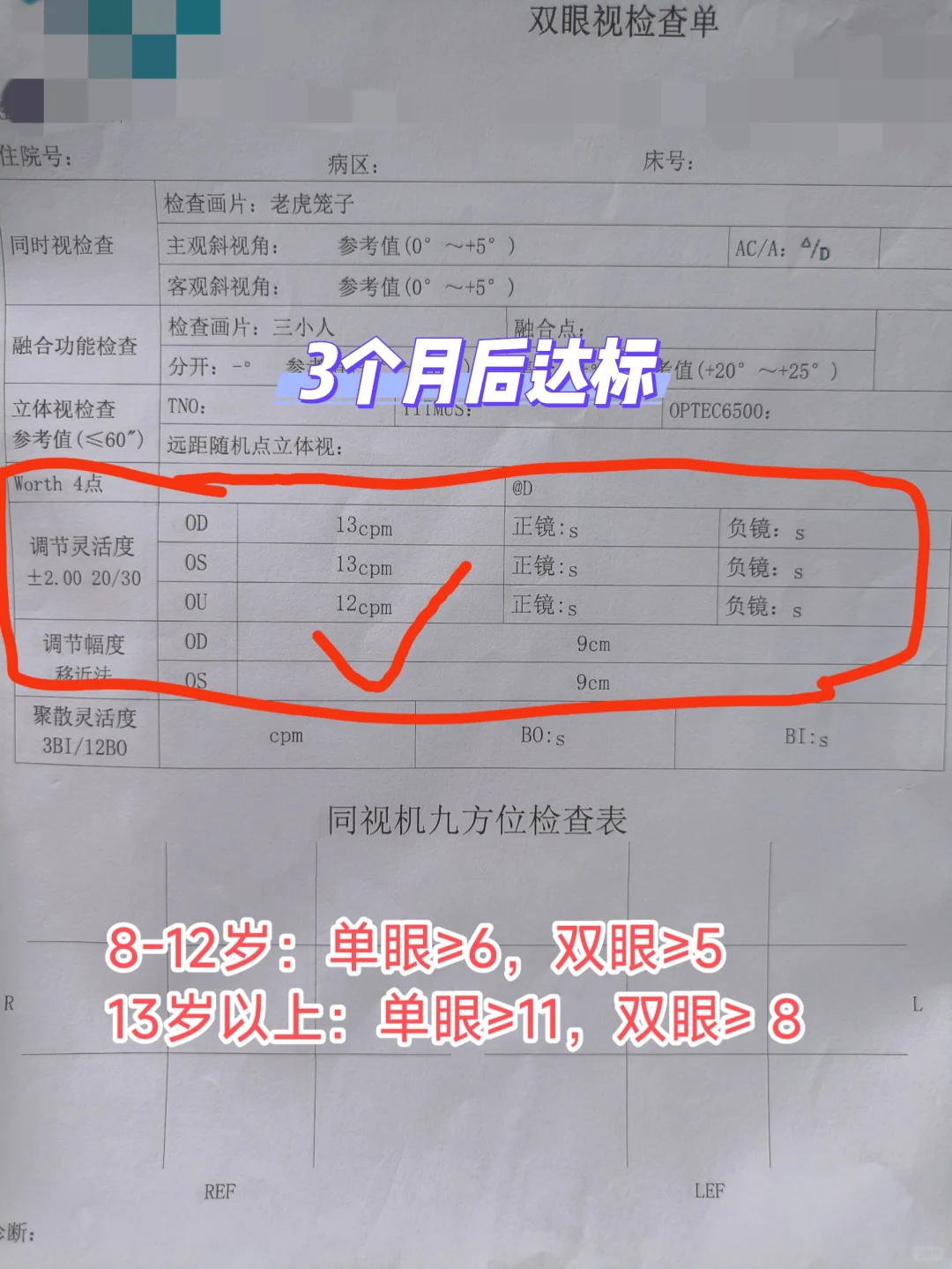 成年后近视度数不断加深的原因找到了4️⃣