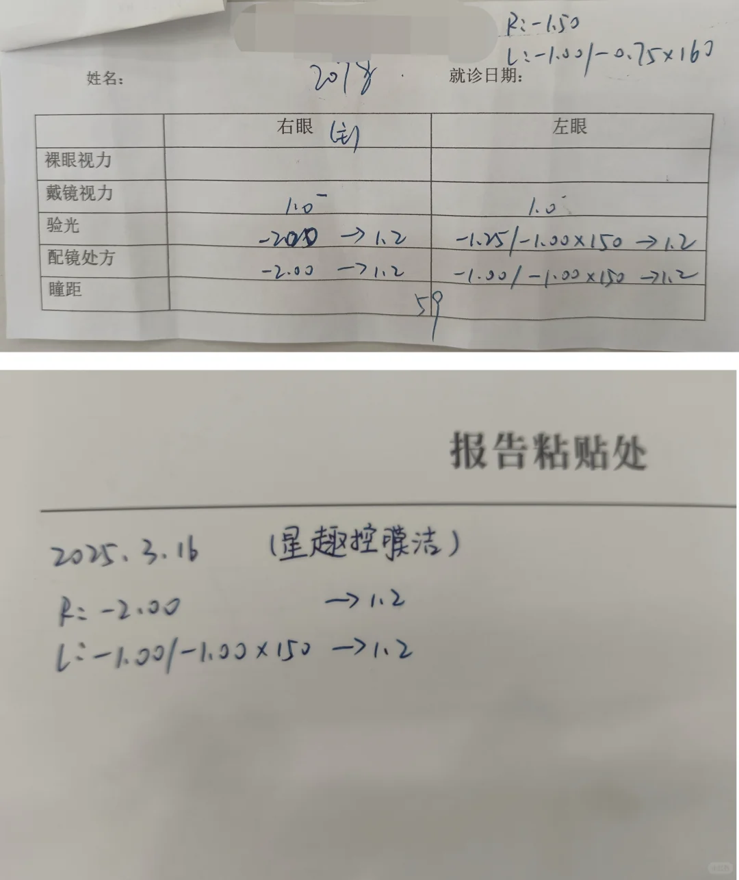 视力是衡量度数有没有变化的标准吗？