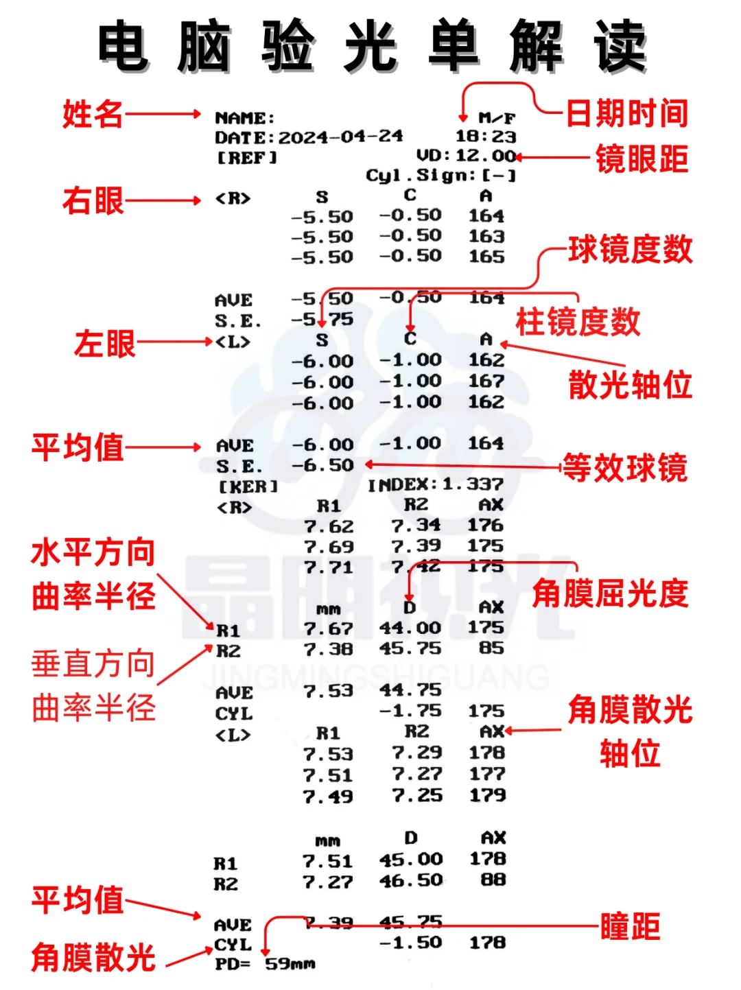 最全最详细的【电脑验光单】详解！一看就会