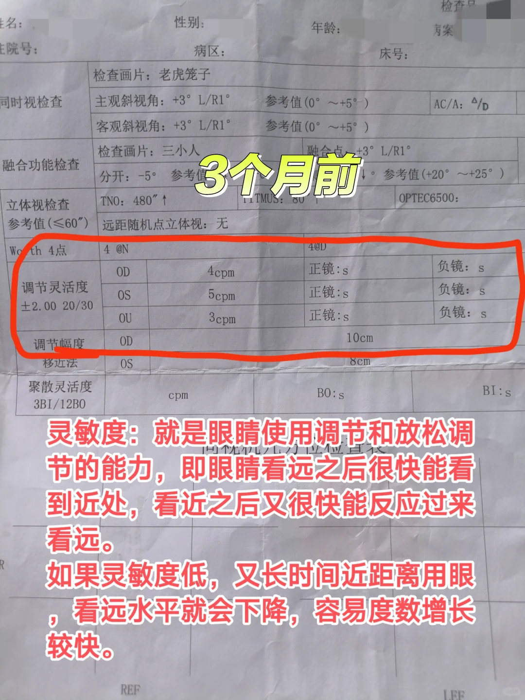 成年后近视度数不断加深的原因找到了4️⃣
