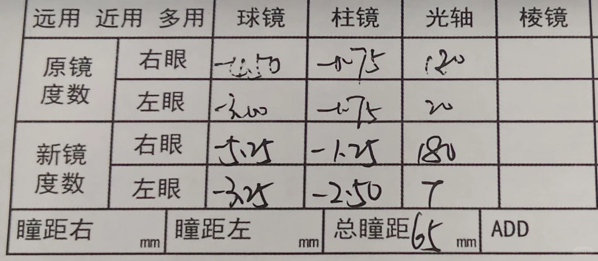 两周右眼近视降了25度 散光降了50度