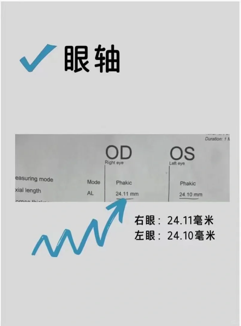 初步判断孩子有没有近视?