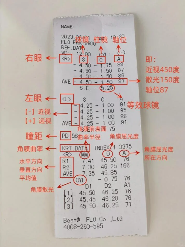 1分钟学会看懂验光单??