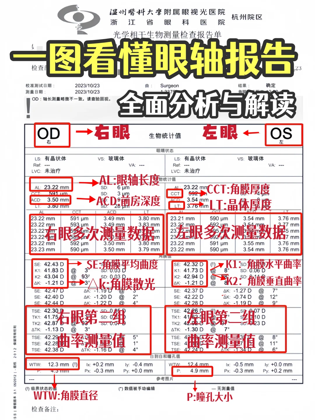 1分钟看懂验光单?轻松掌握孩子视力状况