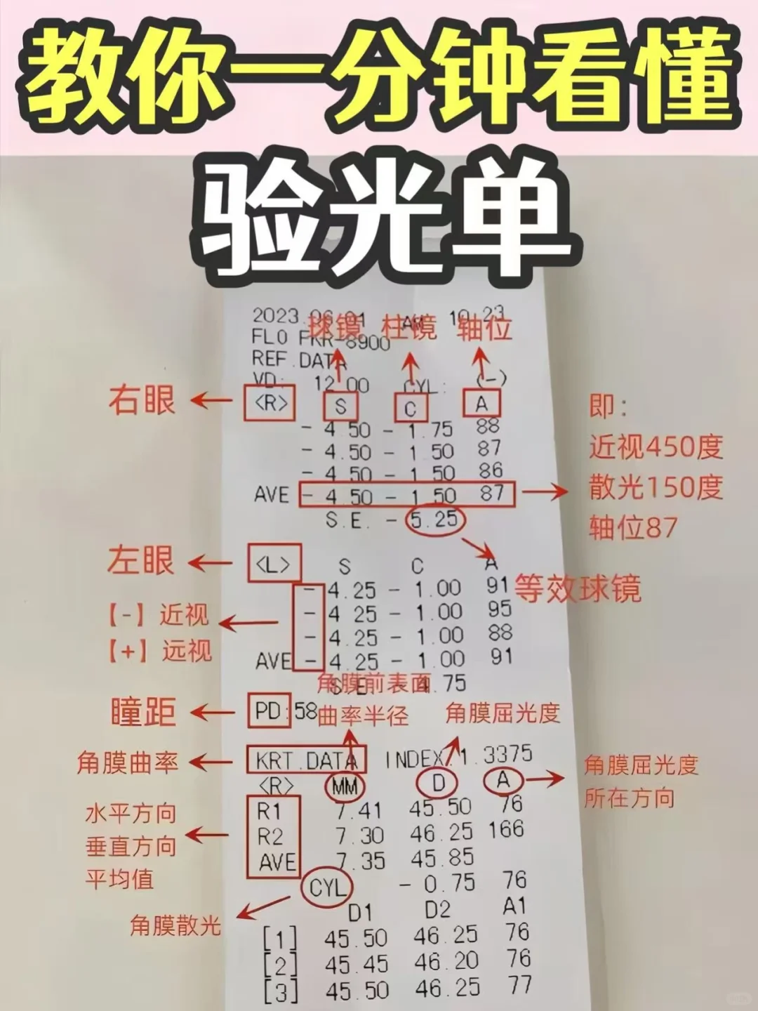 1分钟看懂验光单?轻松掌握孩子视力状况