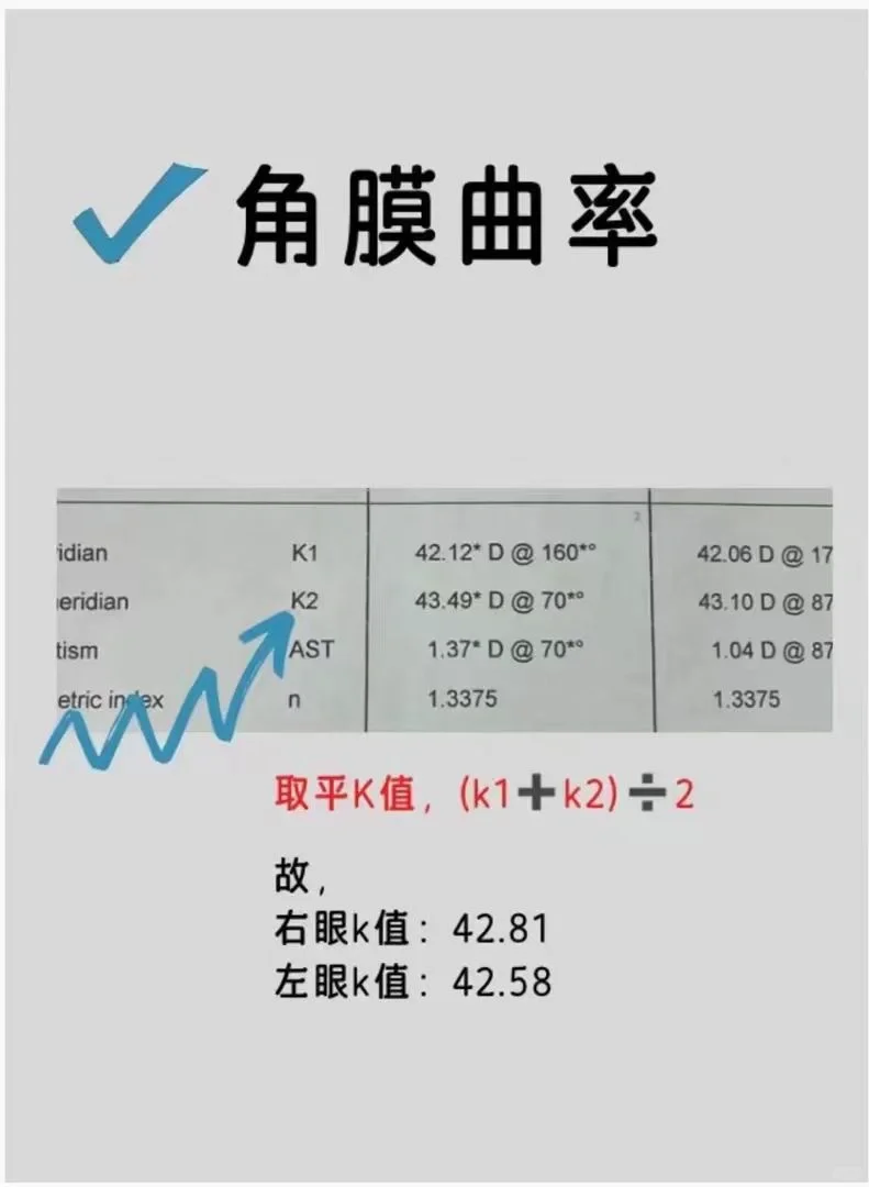 初步判断孩子有没有近视?