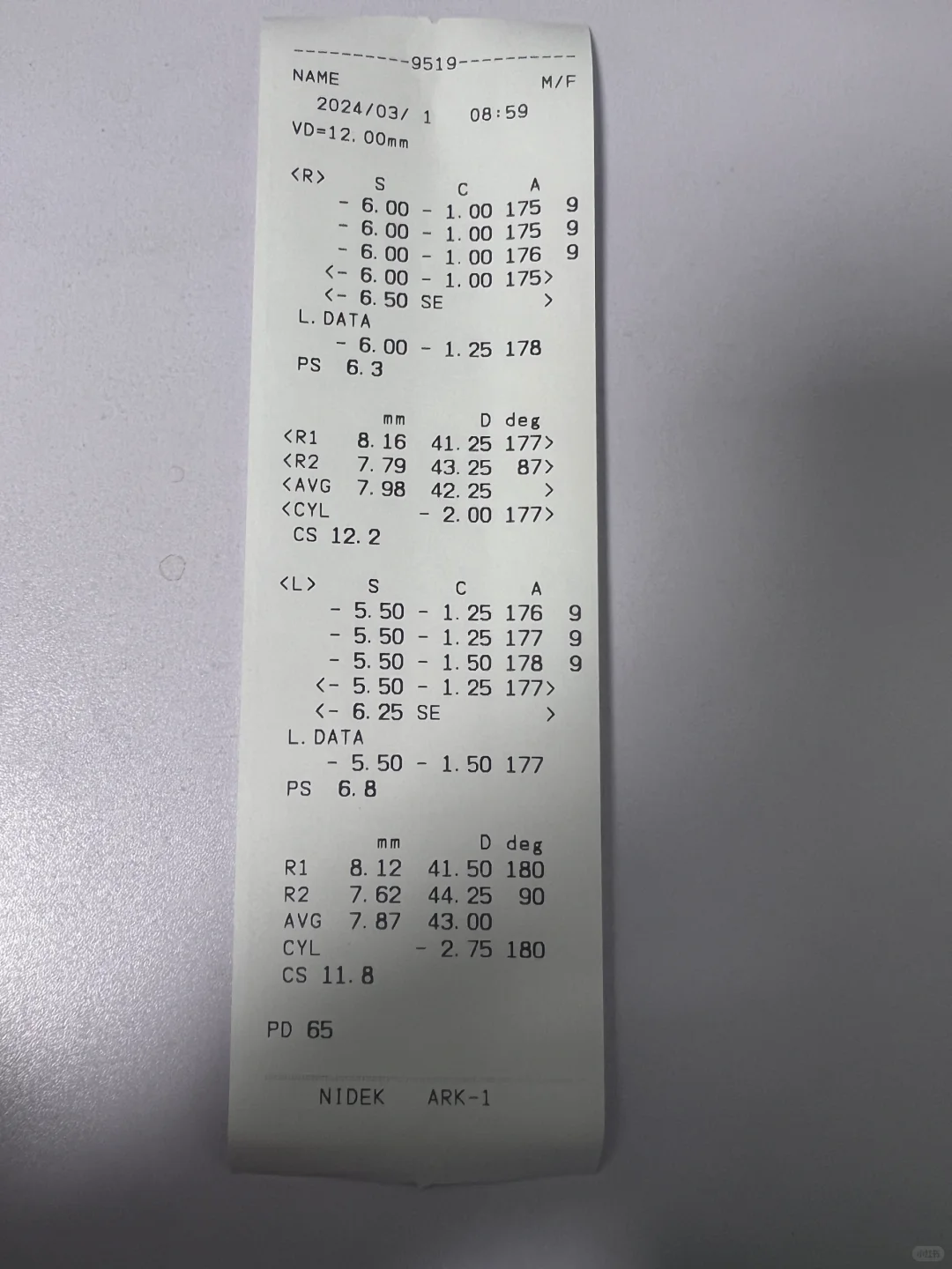 验光条的度数真的准确嘛