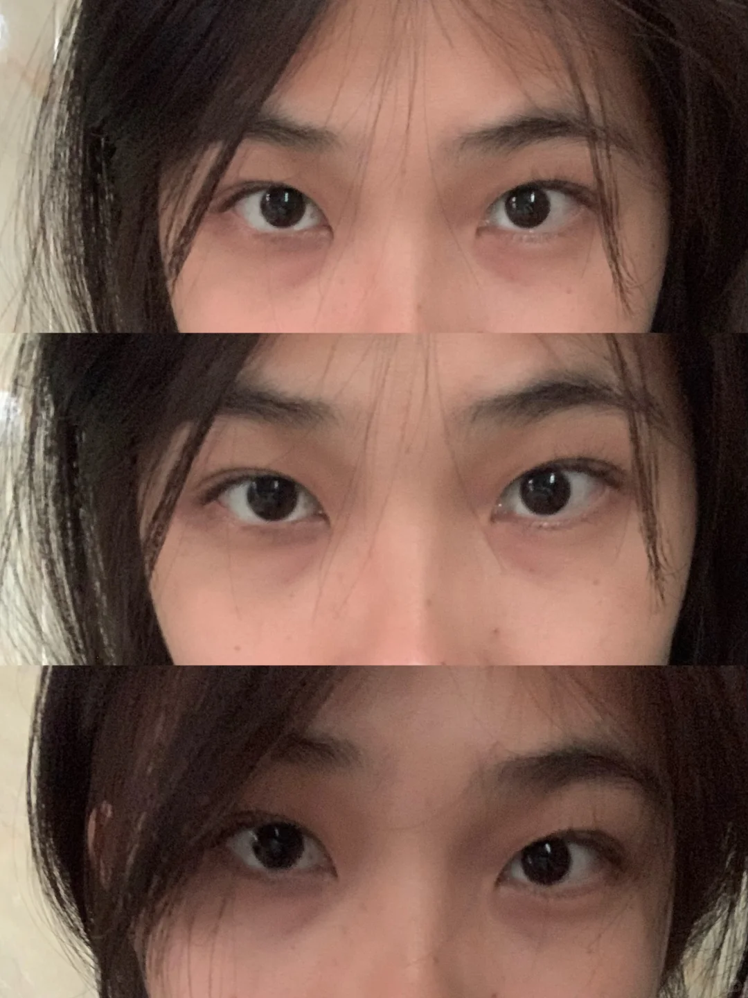 近视快700度的眼睛…