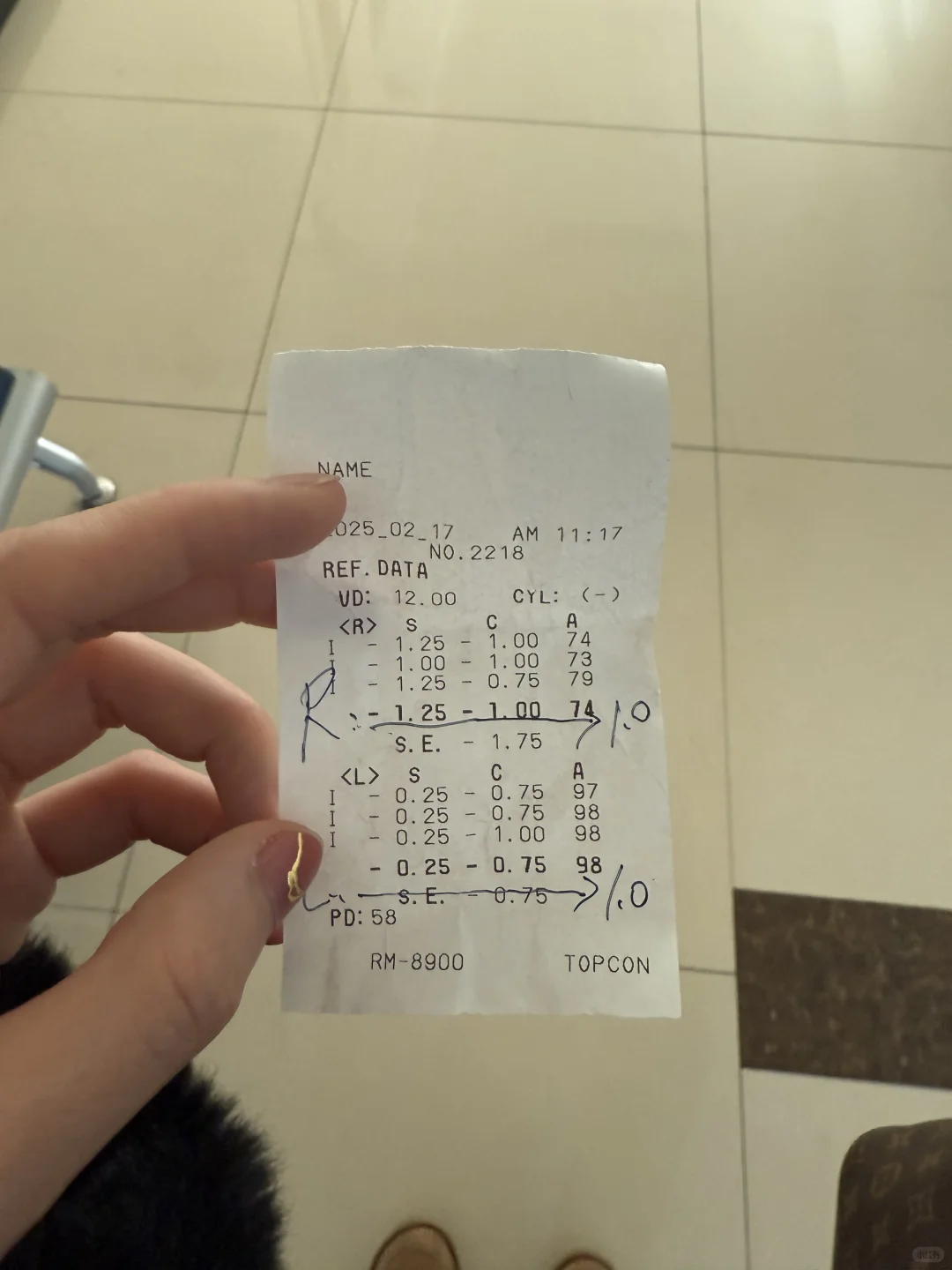 三百多度左右的近视 这几年直线下降到好了？