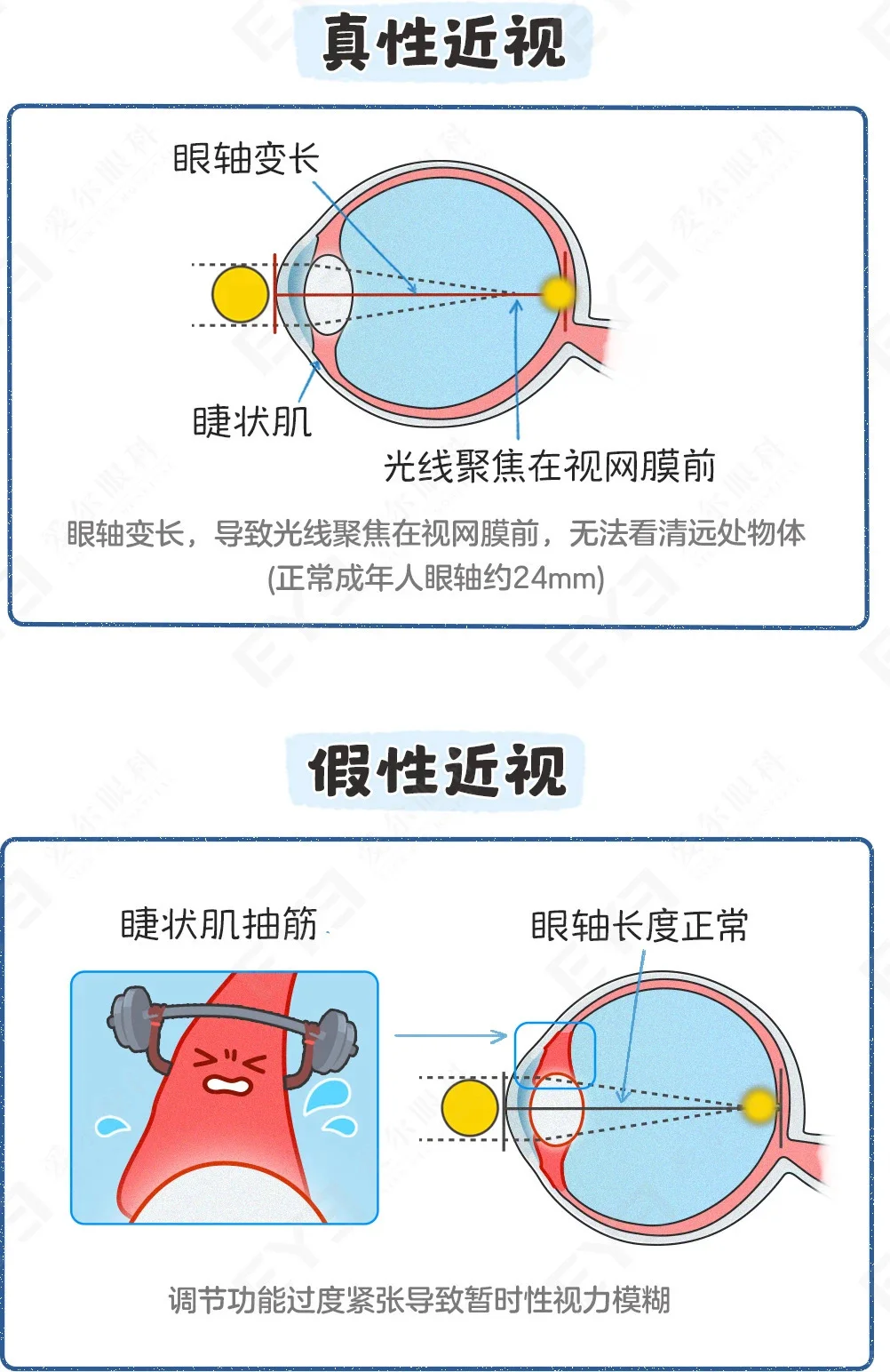 孩子近视50度，要马上配眼镜吗？?