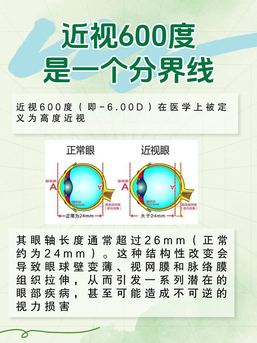 近视600度是一个分界线