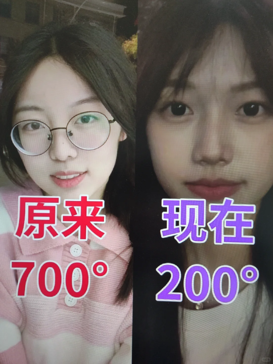 高度近视蜕变中。。。