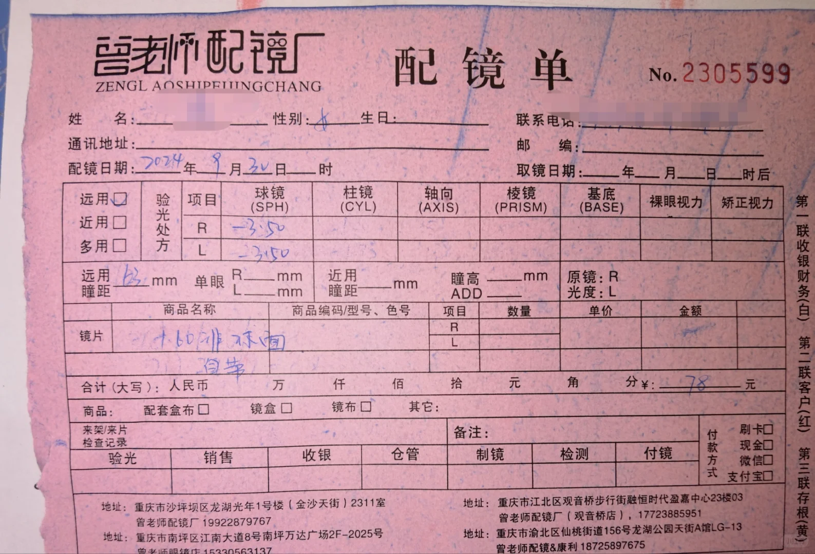 ?逆转近视第10个月：双眼450！小兴奋！