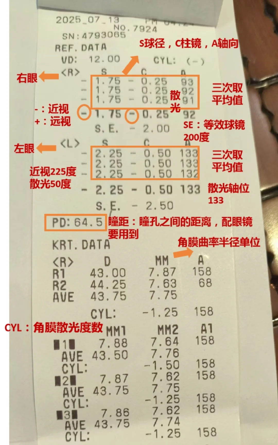 一张图彻底搞懂验光单！配镜不求人?