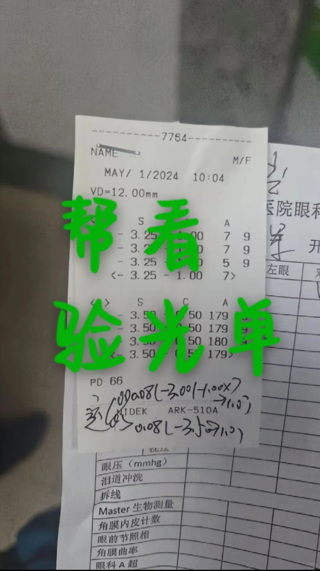 【帮看验光单】验光单上的符号都是啥意思？