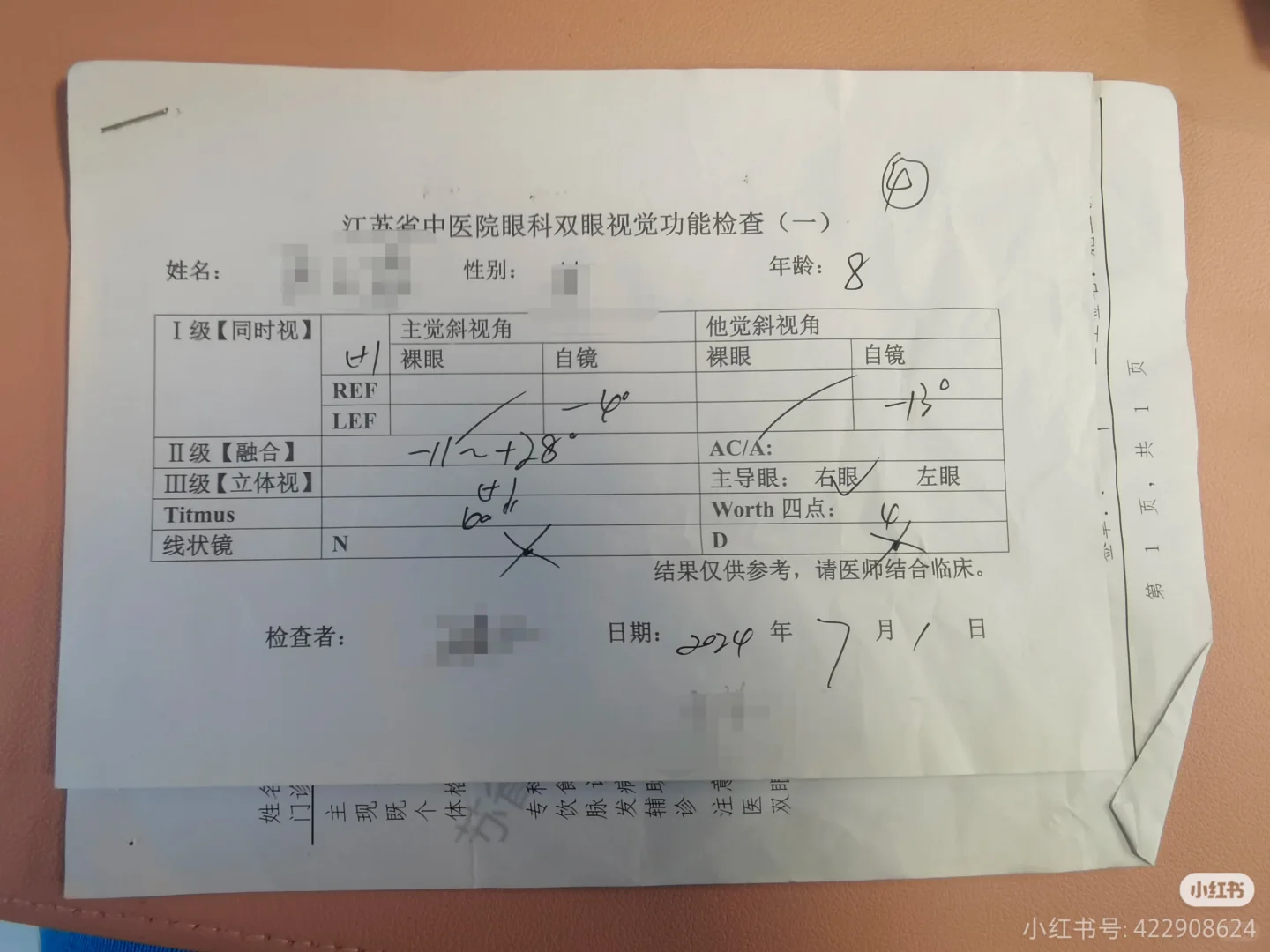 近视真的不可逆吗？近视防控有用吗？