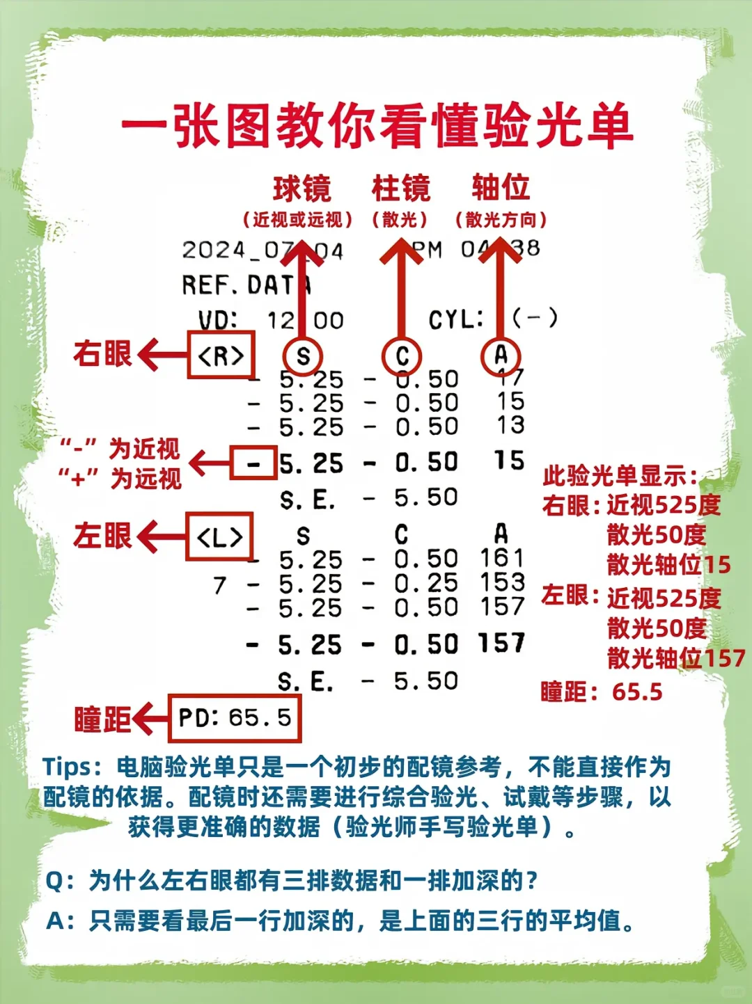球镜和柱镜是什么意思?球镜-0.25近视25度