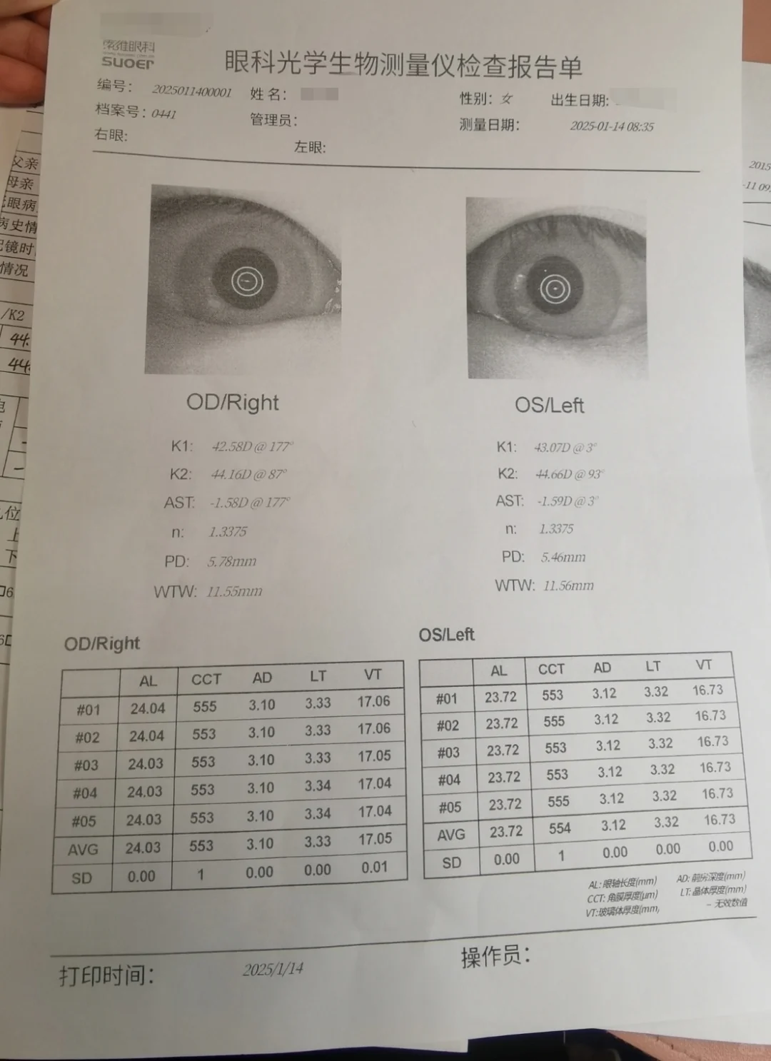 近视真的不可逆吗？近视防控有用吗？