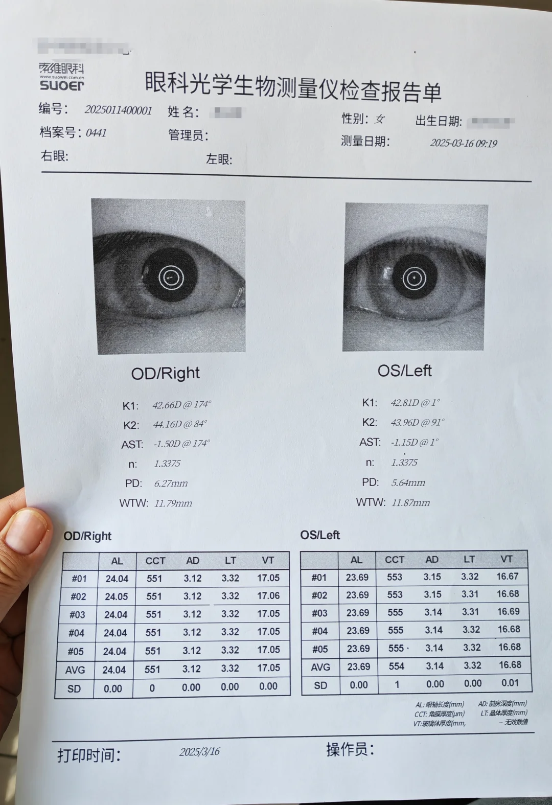 近视真的不可逆吗？近视防控有用吗？