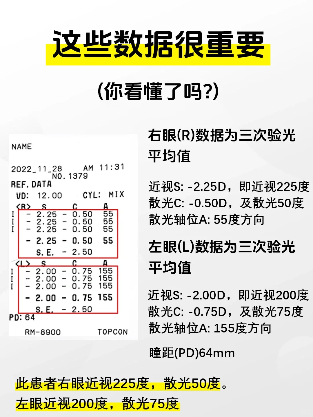 一分钟教你看懂验光单！有用 建议收藏