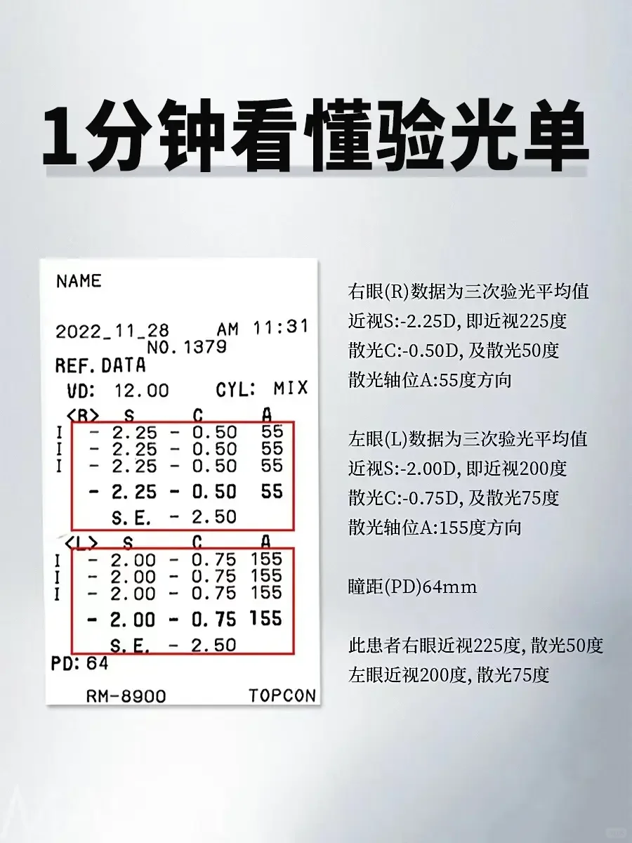 球镜和柱镜是什么意思?球镜-0.25近视25度