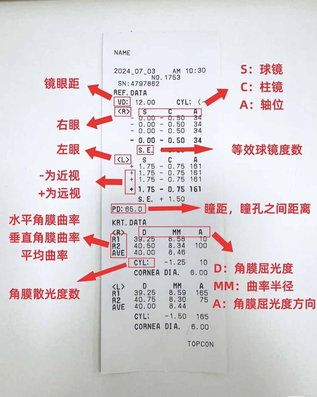 验光单解读❗️看不懂的拿单咨询❗️