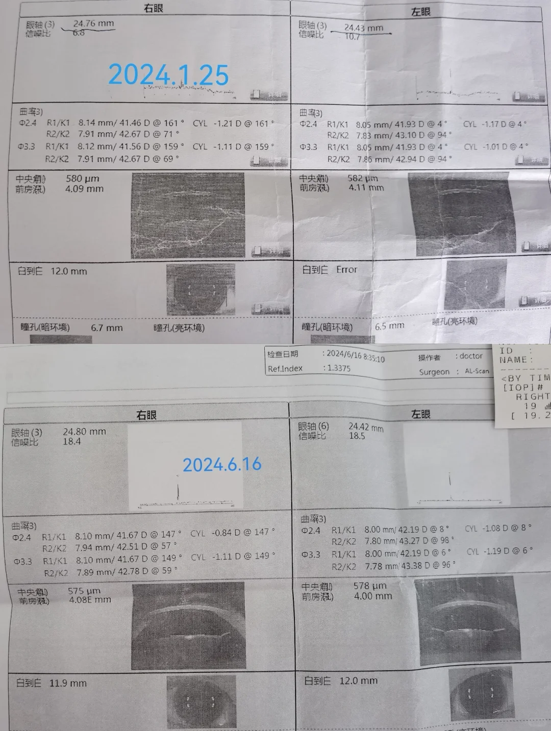 控优点40天退轴0.21