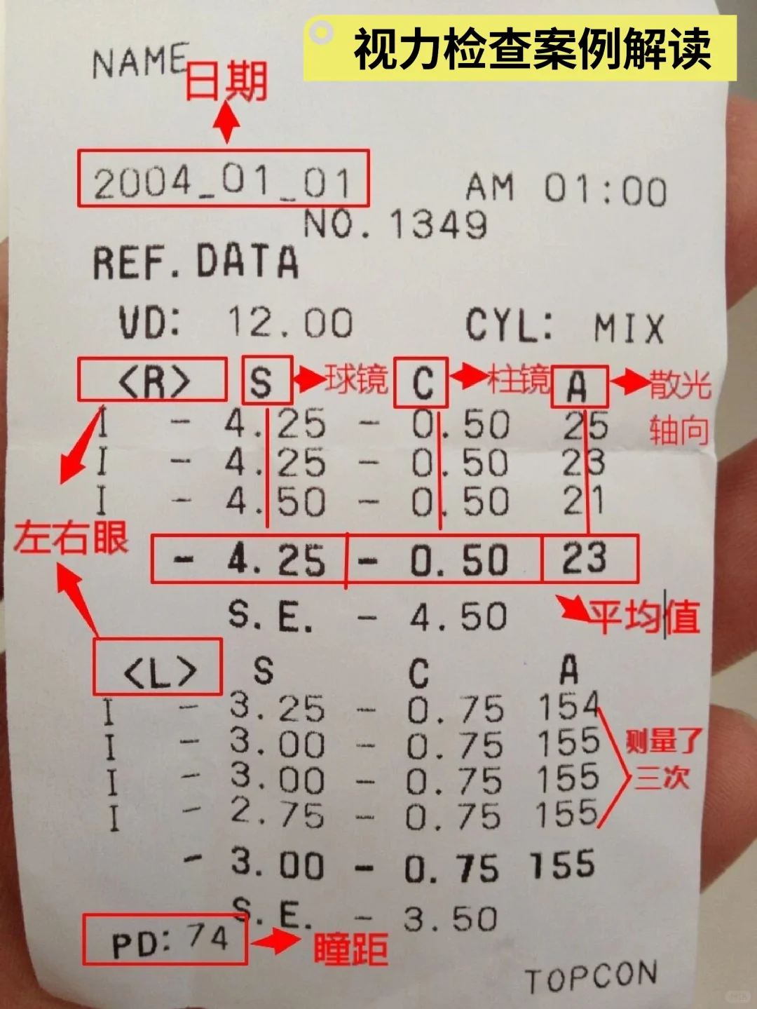 视力表知识集合