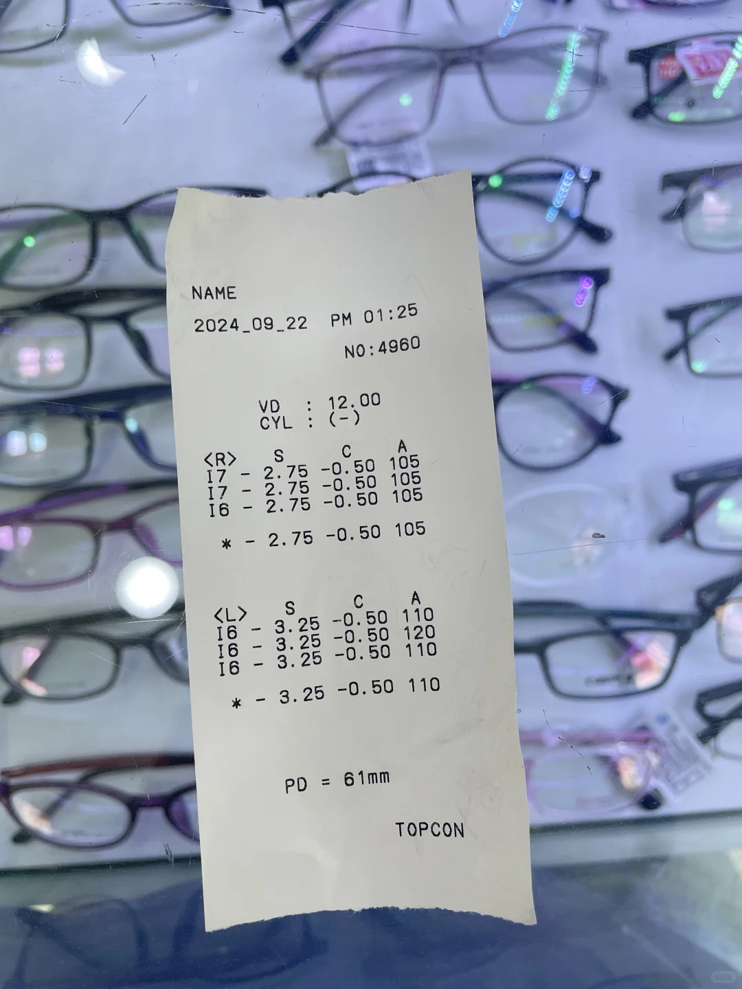 眼镜店是不是把我眼镜度数配高了