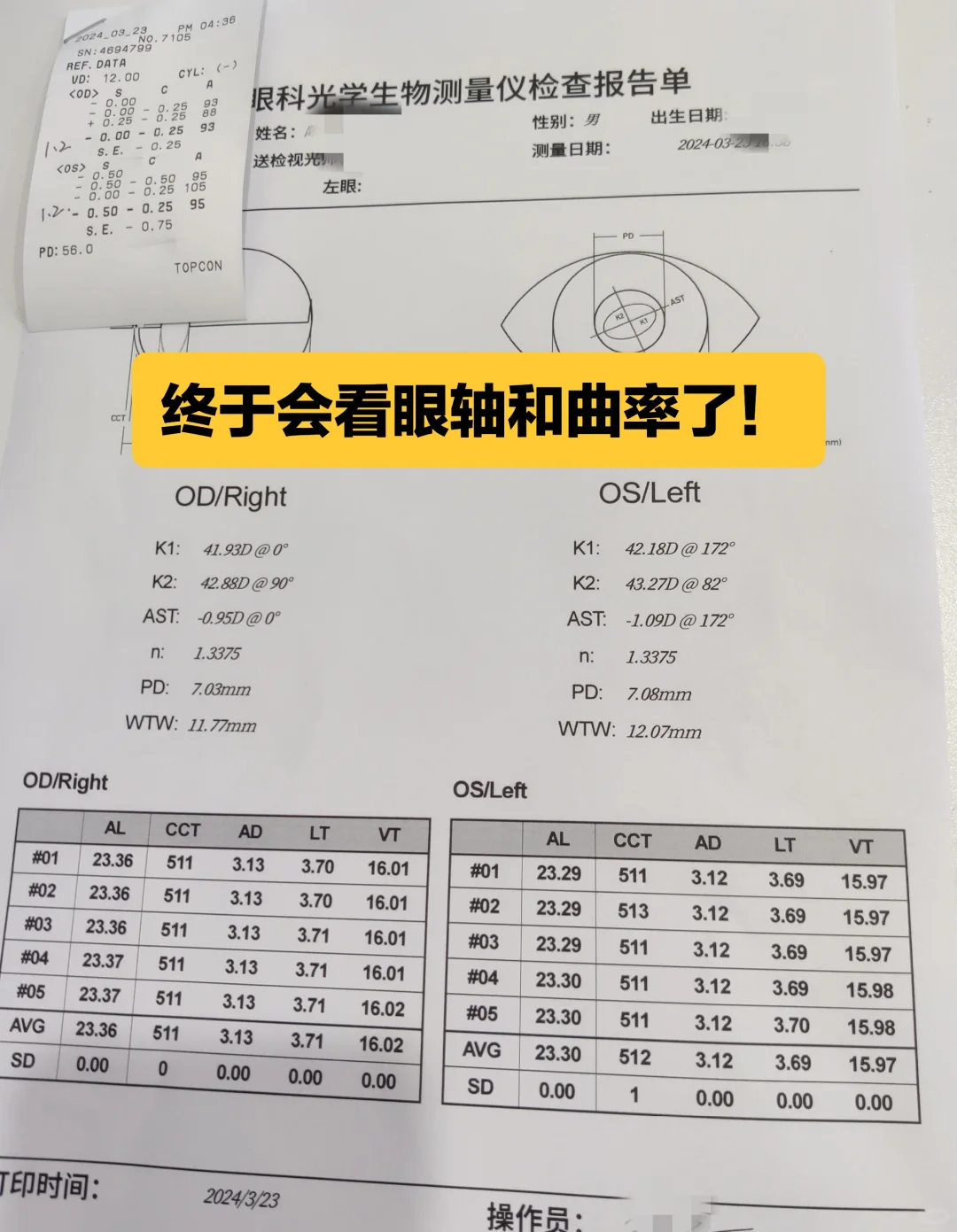 终于看懂眼轴和曲率的检查报告了