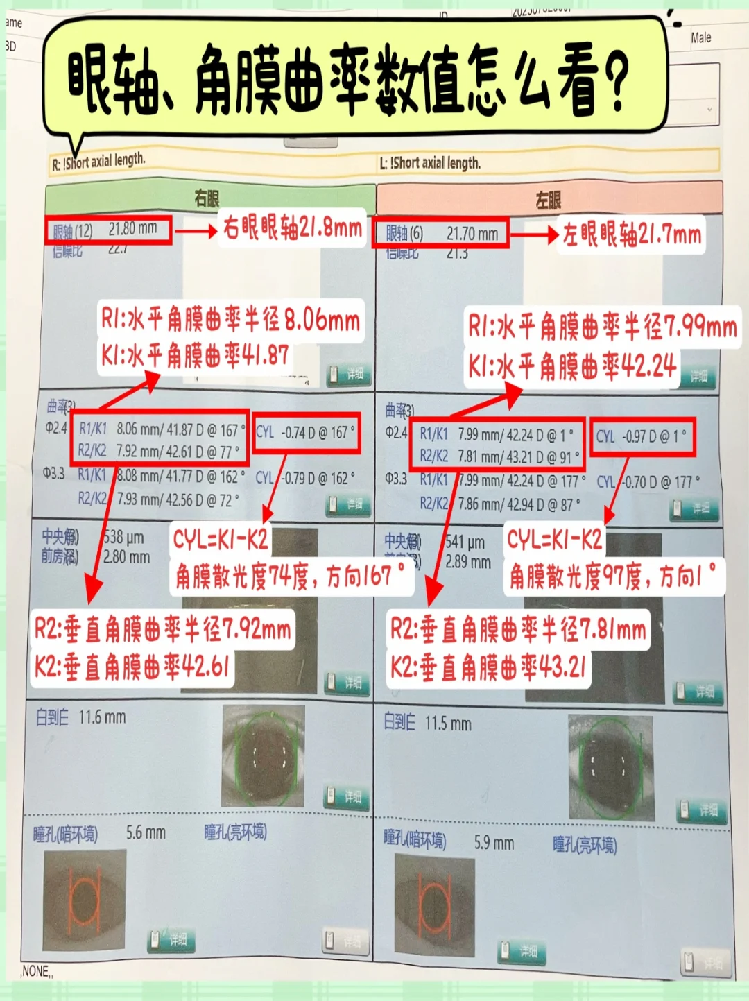 一分钟快速看懂孩子视力验光单