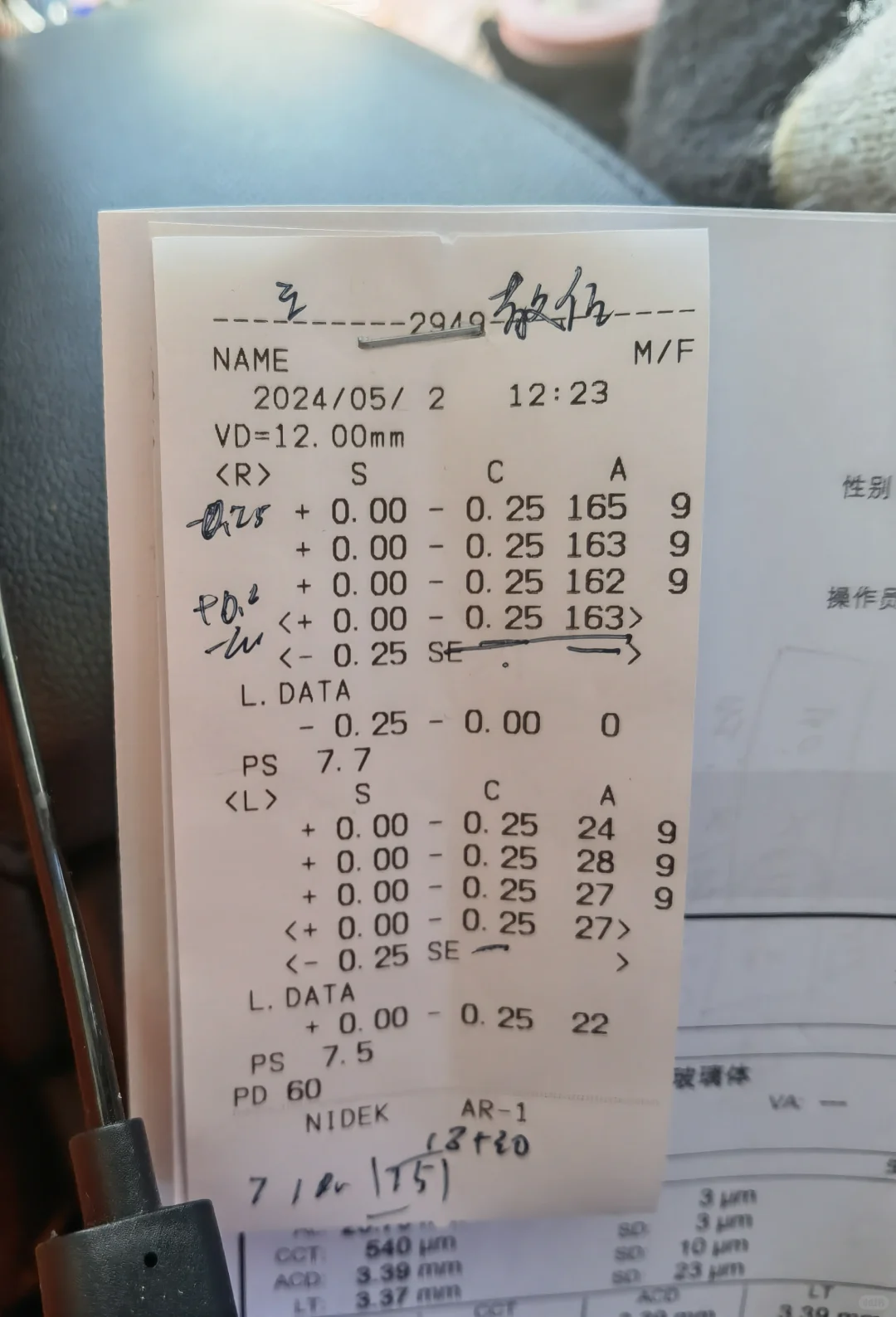 两年近视清零了