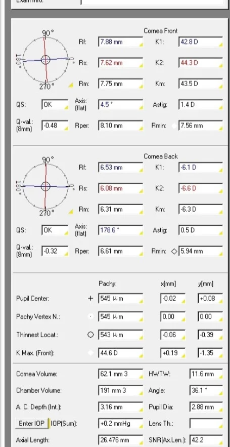 近视眼手术建议
