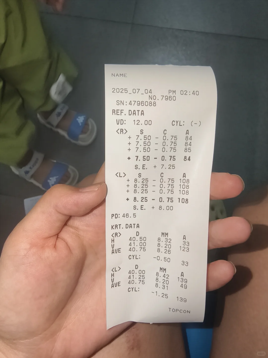 散瞳前后差距真大