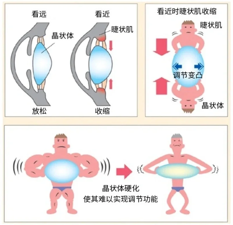 眼科知识小科普