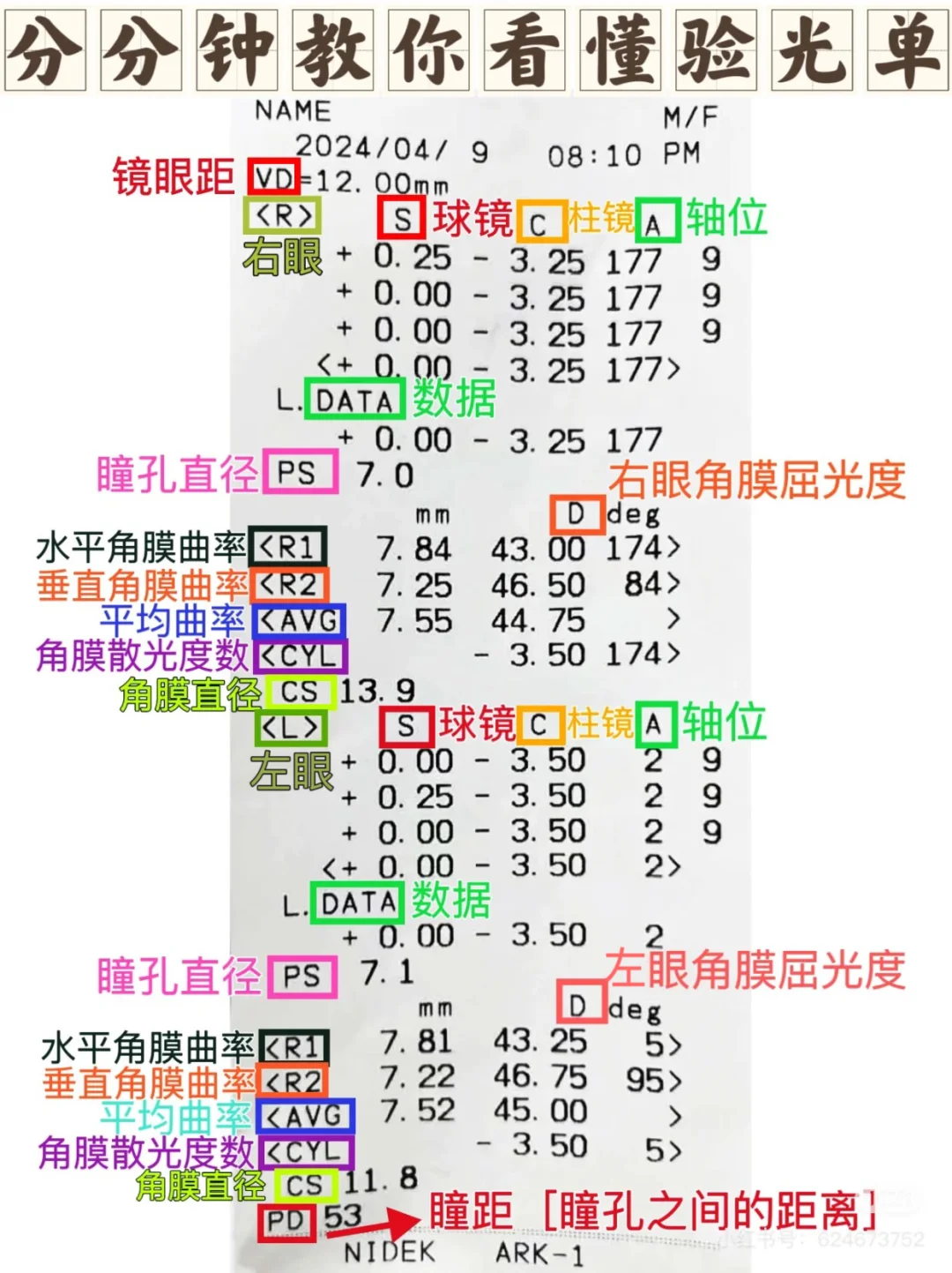 如何通过✅验光单、眼压单看懂你的眼睛?度数