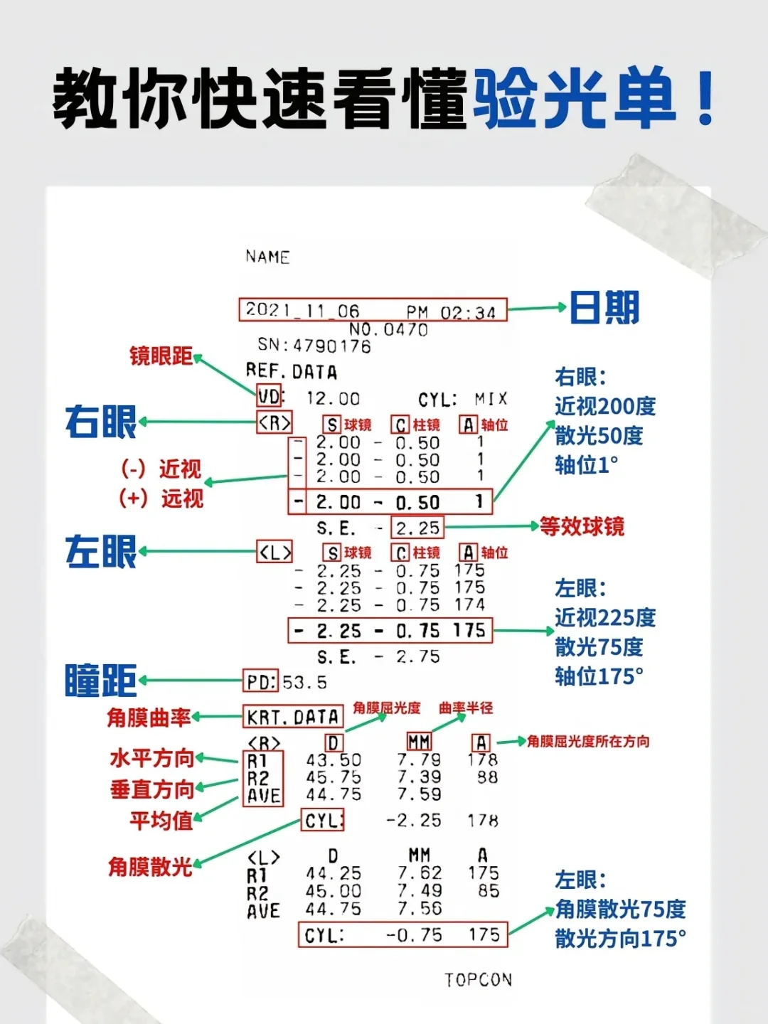odos哪个右眼哪个左眼？教你验光单怎么看！
