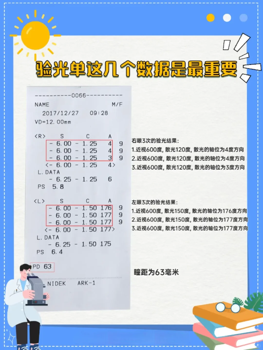 odos哪个右眼哪个左眼？教你验光单怎么看！