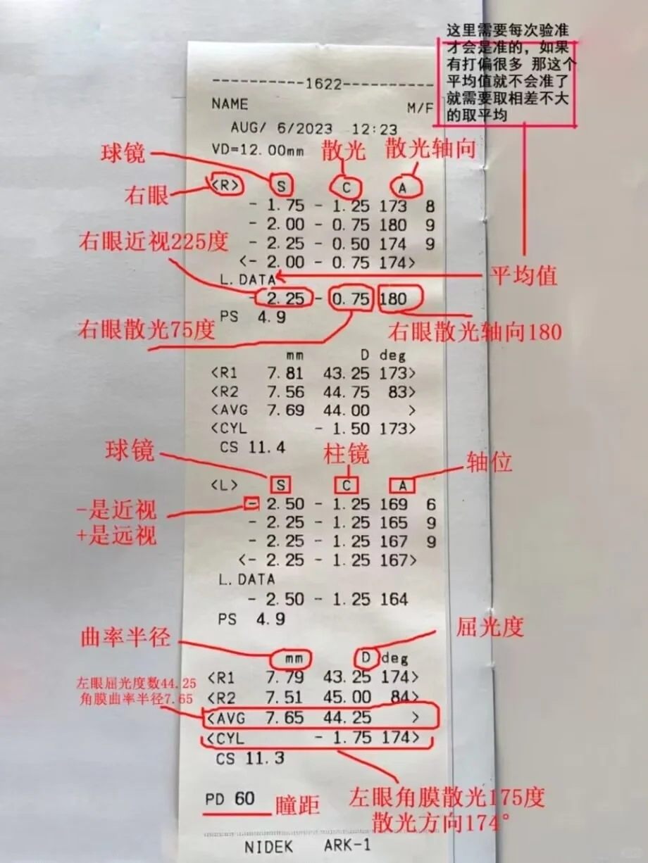 一张图教你看懂验光单