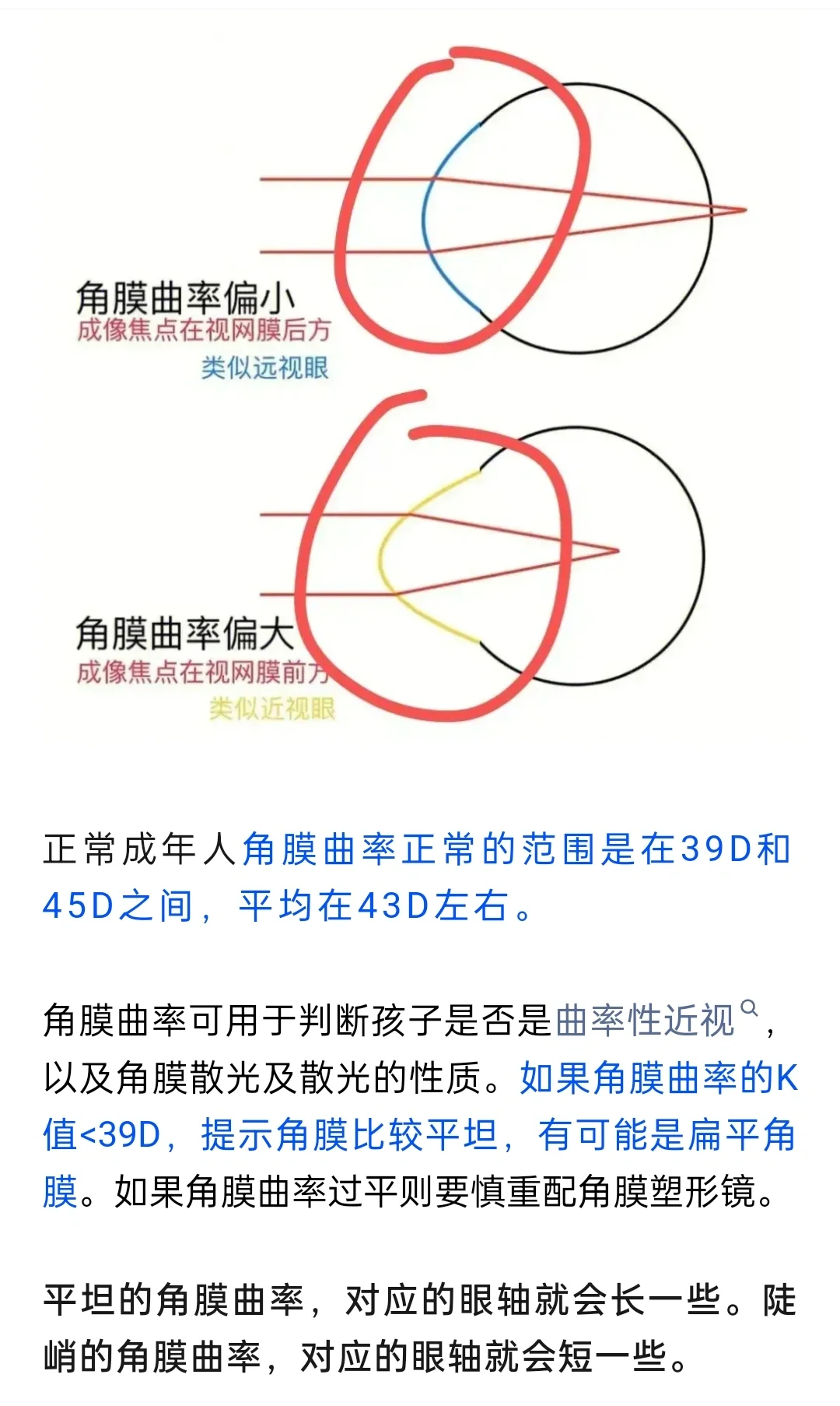 终于看懂眼轴和曲率的检查报告了