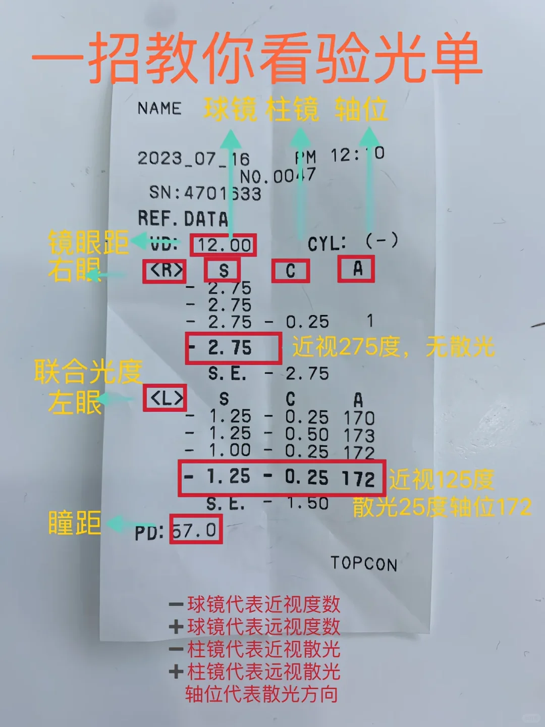 odos哪个右眼哪个左眼？教你验光单怎么看！