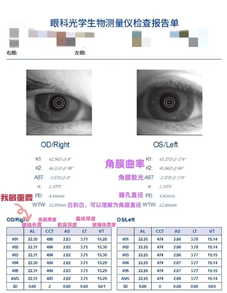 学习如何看自己的眼光学生物测量报告