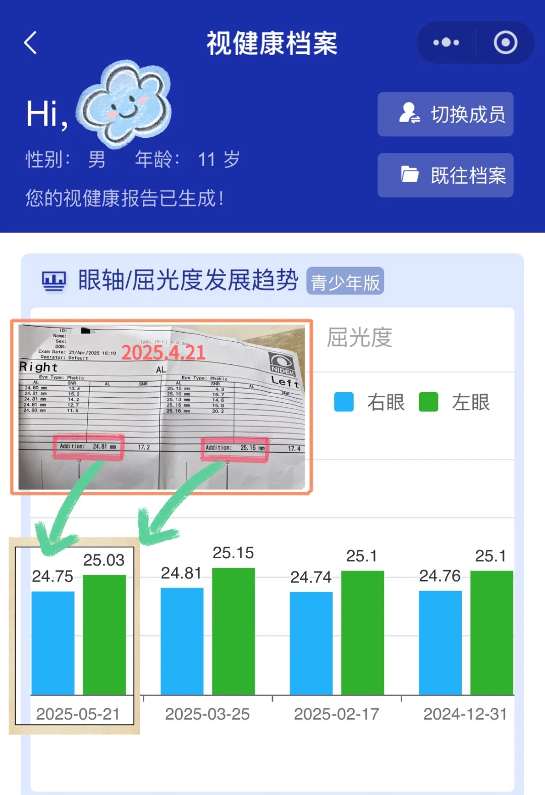 离焦镜+读写台,七个月退轴度数零增长