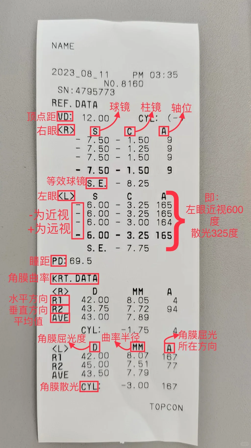 一分钟教你看懂验光单！