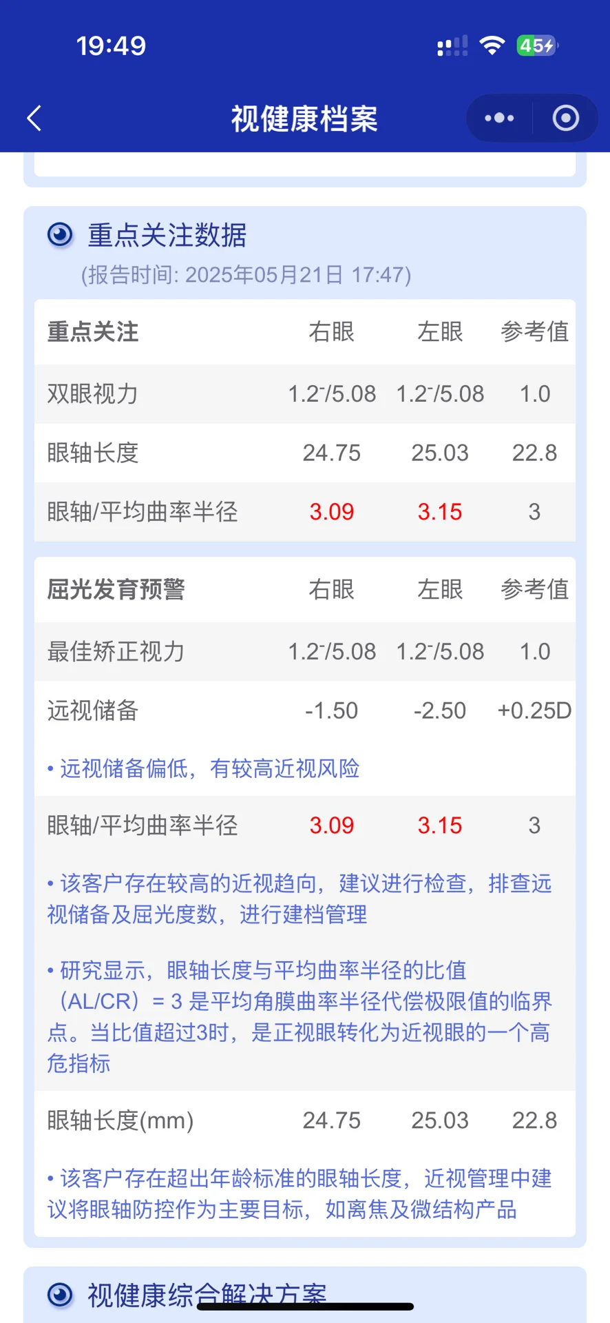 离焦镜+读写台,七个月退轴度数零增长