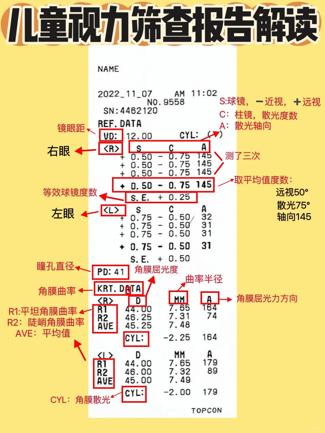 ?一分钟看懂儿童视力筛查报告