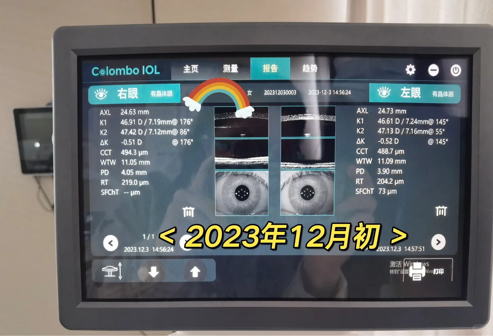 去眼科测了个视力，比月初降了100度