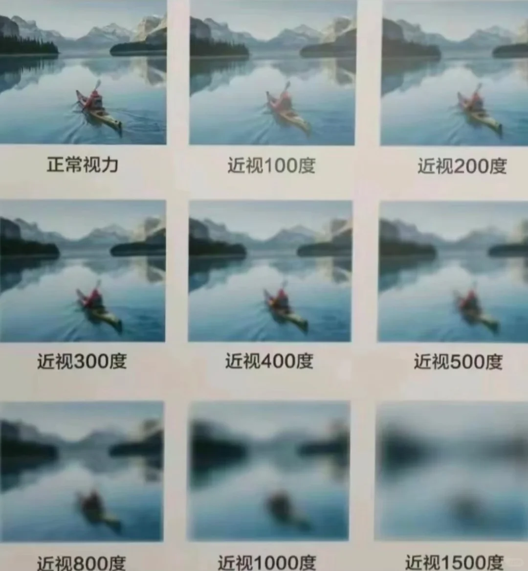 必懂！近视散光远视大白话科普