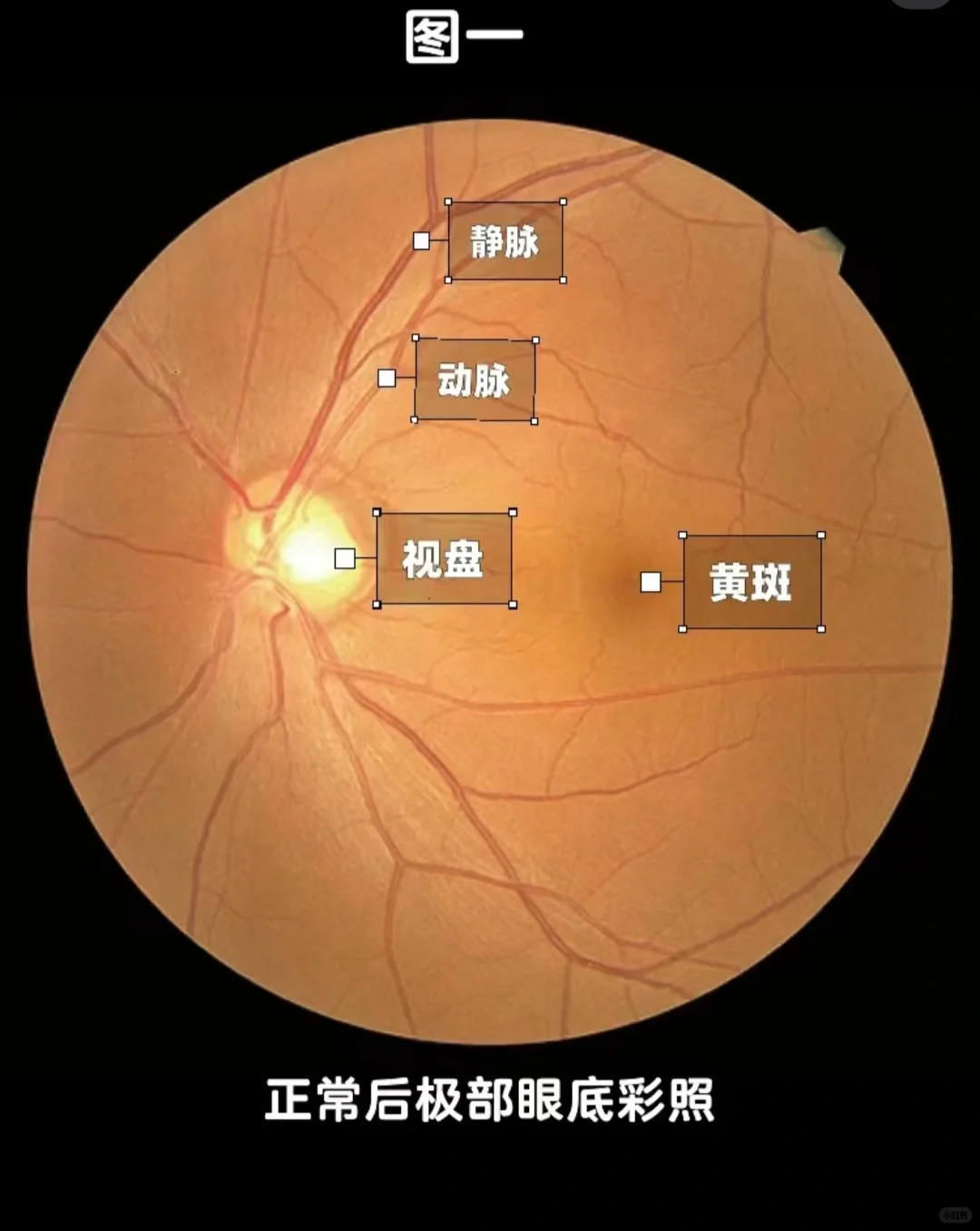 眼科知识小科普